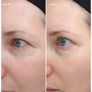 Colorescience Total Eye Firm & Repair Cream 18ml