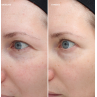 Colorescience Total Eye Firm & Repair Cream 18ml