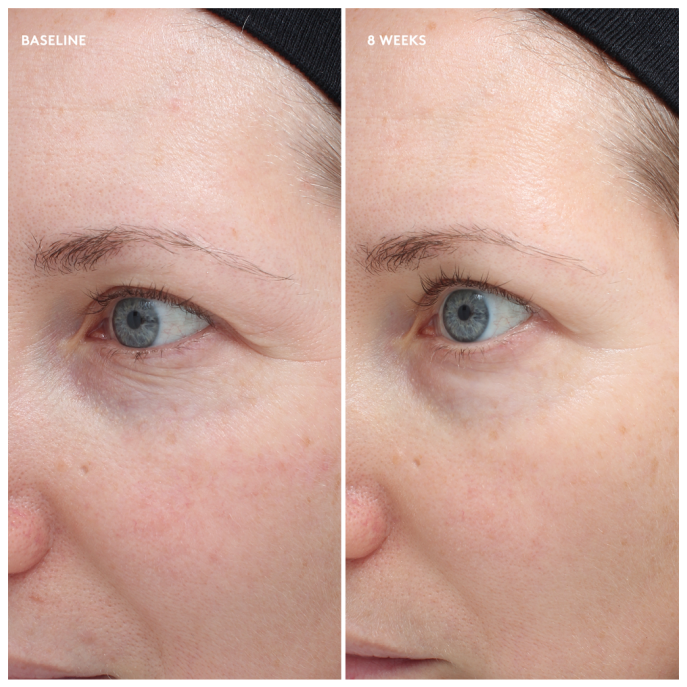 Colorescience Total Eye Firm & Repair Cream 18ml (2 vnt.)