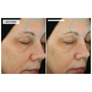 Dermaquest Peptide 3D Eye Lift 15ml