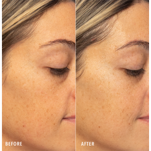 HydroPeptide HydroLuxe Oxygen Facial