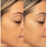 HydroPeptide HydroLuxe Oxygen Facial