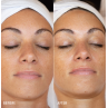 HydroPeptide HydroLuxe Oxygen Facial