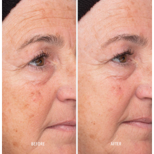 HydroPeptide Liquid Resurfacing Solution 120ml