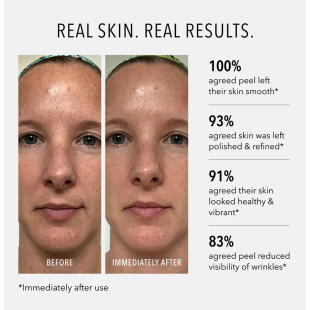 HydroPeptide Polish & Plump Face Peel 2x30ml