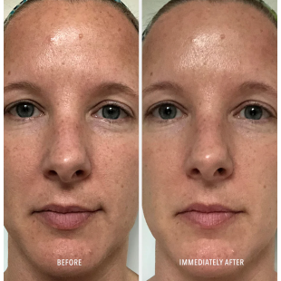 HydroPeptide Polish & Plump Face Peel 2x30ml