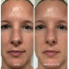 HydroPeptide Polish & Plump Face Peel 2x30ml