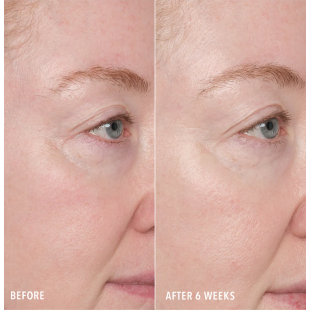 HydroPeptide Resurface & Repair Peptide Pads 30 vnt.