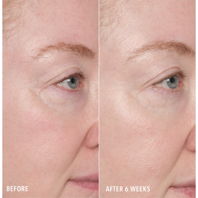 HydroPeptide Resurface & Repair Peptide Pads 30 vnt.