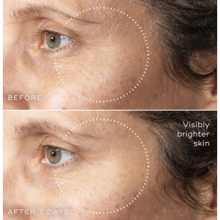 Medik8 C-Tetra Advanced 30ml