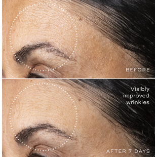 Medik8 C-Tetra Advanced 30ml