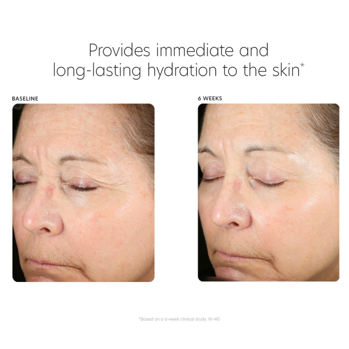 PCA Skin Hyaluronic Acid Boosting Serum 30ml