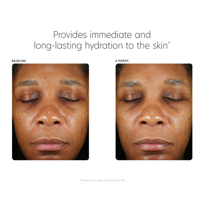 PCA Skin Hyaluronic Acid Boosting Serum 30ml
