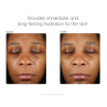 PCA Skin Hyaluronic Acid Boosting Serum 30ml