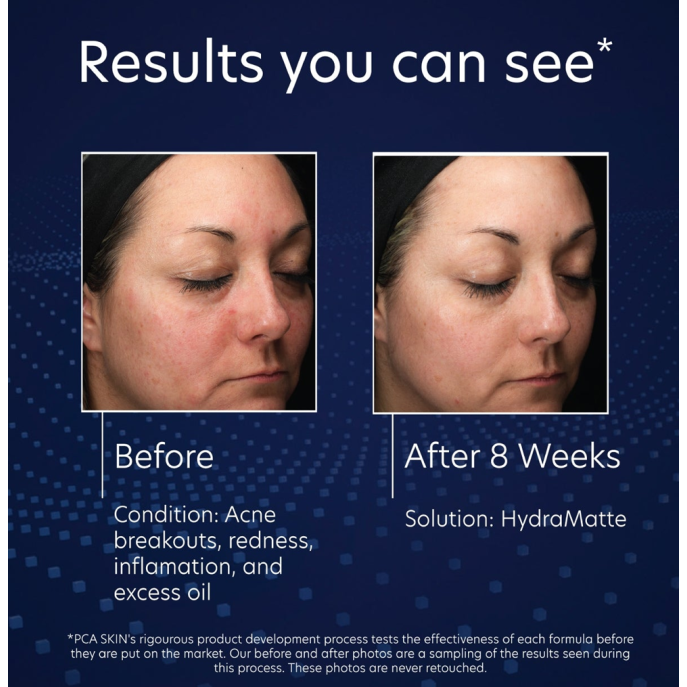 PCA Skin HydraMatte 50ml