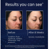 PCA Skin HydraMatte 50ml