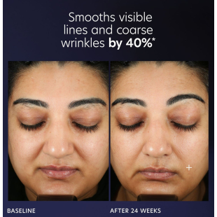 PCA Skin Pro-Max Age Renewal 30ml