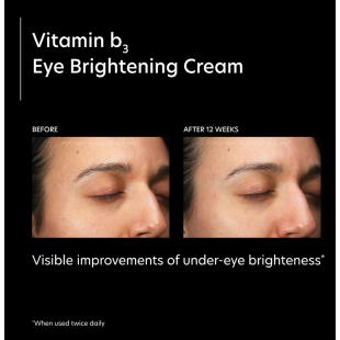 PCA Skin Vitamin B3 Eye Brightening Cream 13g