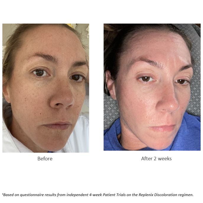 Replenix Glycolic Acid 10% Resurfacing Peel 60 pads