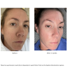 Replenix Glycolic Acid 10% Resurfacing Peel 60 pads