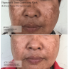 Senté Pigment & Tone Correcting Mask 50ml