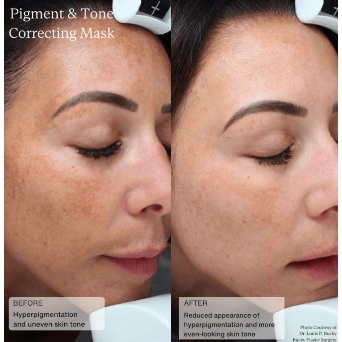 Senté Pigment & Tone Correcting Mask 50ml