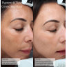 Senté Pigment & Tone Correcting Mask 50ml
