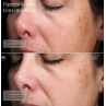 Senté Pigment & Tone Correcting Mask 50ml
