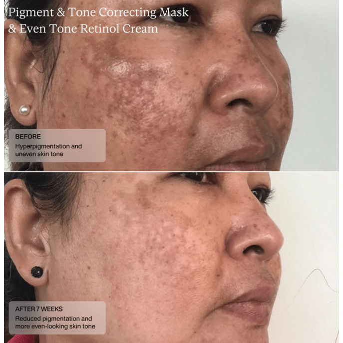 Senté Pigment & Tone Correcting Mask 50ml