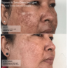 Senté Pigment & Tone Correcting Mask 50ml
