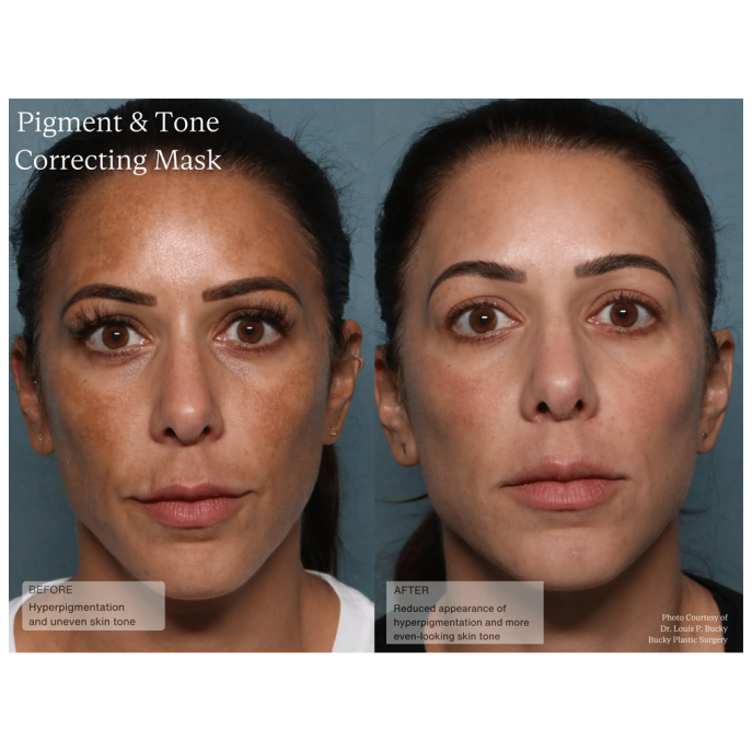 Senté Pigment & Tone Correcting Mask 50ml