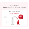 Zeroid Pimprove Moisturizer 100ml (2 vnt.)
