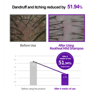 Zeroid Rootheal Mild Shampoo 300ml