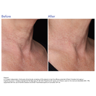 ZO Skin Health Neck Complex Anti-aging + Brightening Serum 50ml