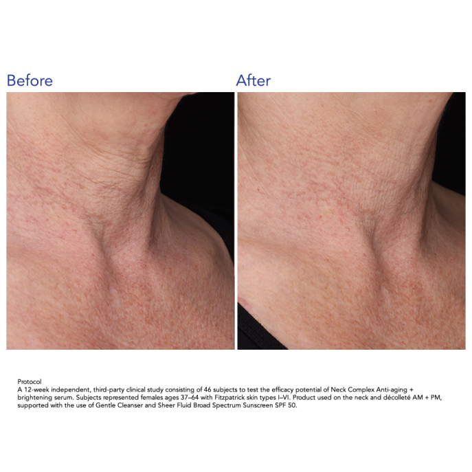 ZO Skin Health Neck Complex Anti-aging + Brightening Serum 50ml