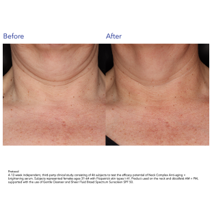 ZO Skin Health Neck Complex Anti-aging + Brightening Serum 50ml