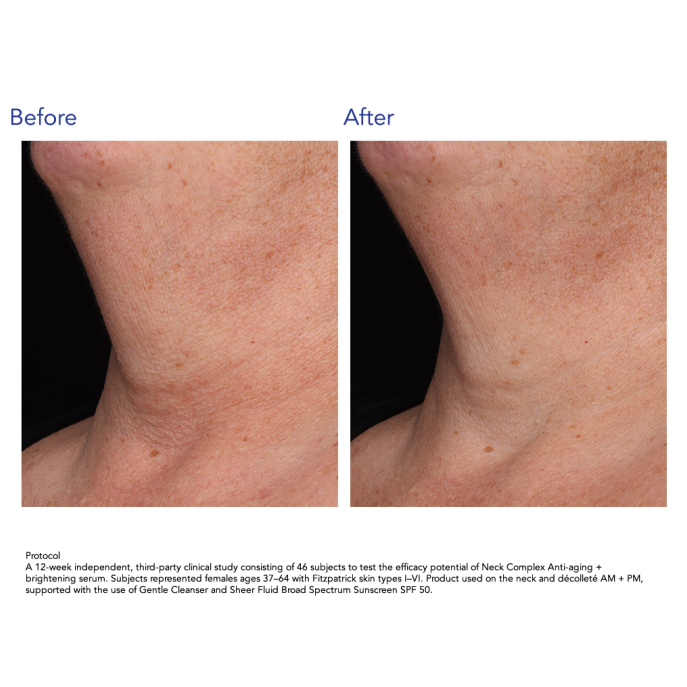 ZO Skin Health Neck Complex Anti-aging + Brightening Serum 50ml